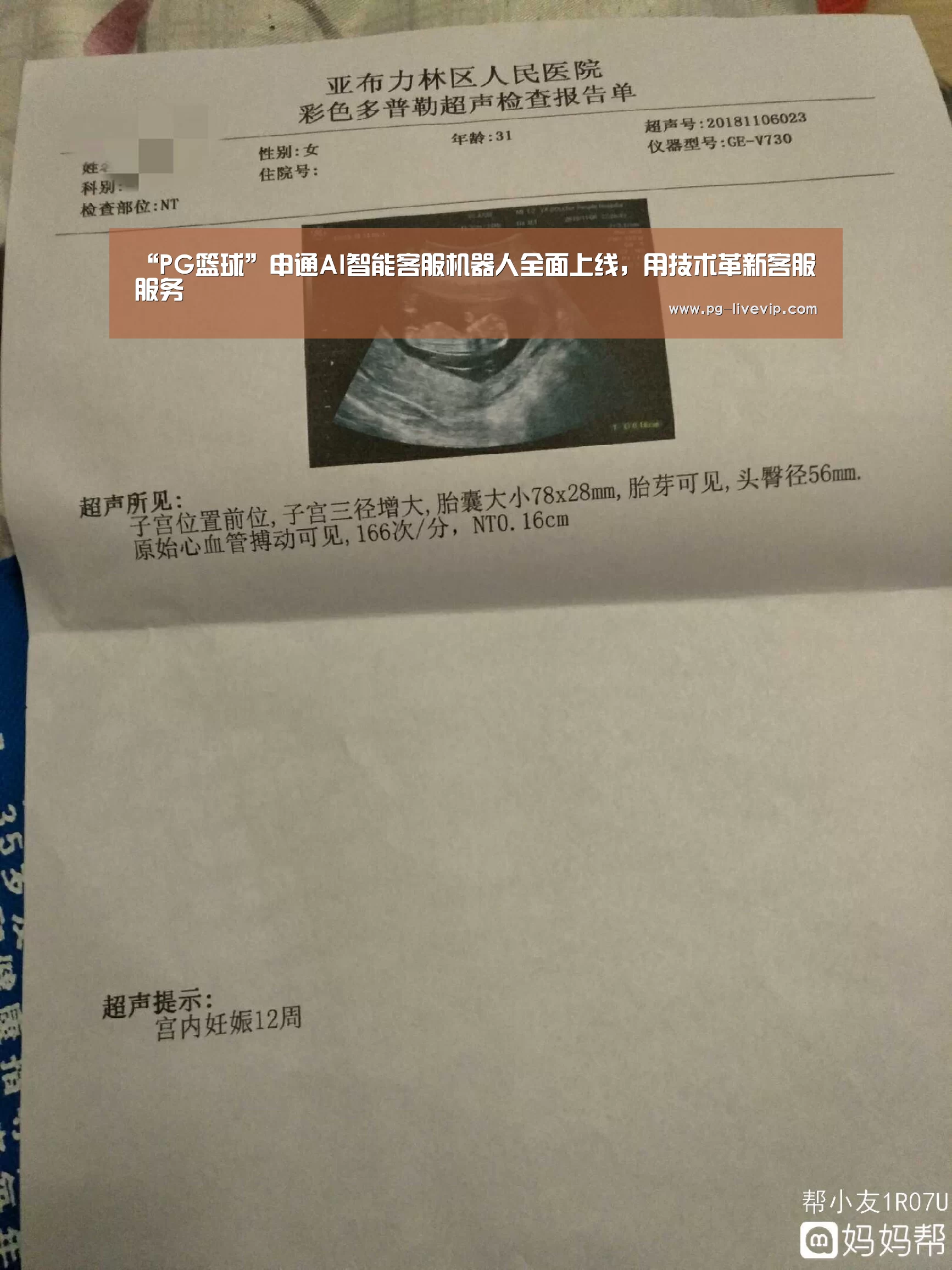 “PG篮球”申通AI智能客服机器人全面上线，用技术革新客服服